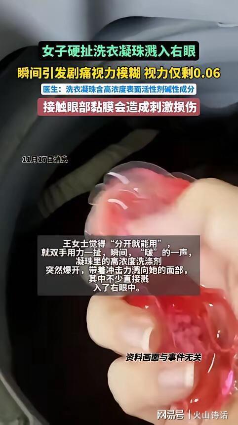 杭州一女子撕扯凝珠发生意外致眼睛失明pg模拟器试玩恐怖！洗衣引发“爆炸”(图2)